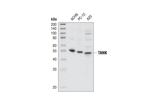Western Blotting Image 1: TANK Antibody