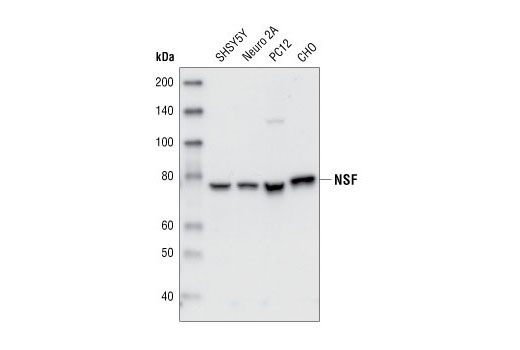 Western Blotting Image 1: NSF Antibody