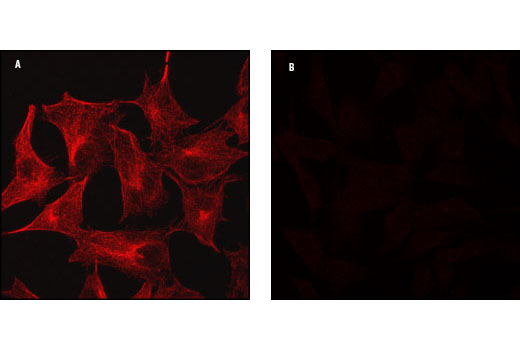 Immunofluorescence Image 1: α/β-Tubulin Antibody