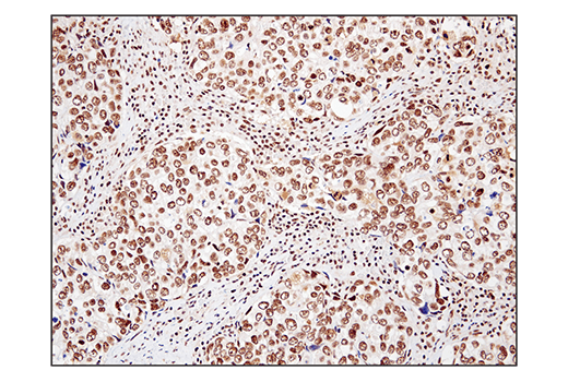 Immunohistochemistry Image 2: SS18 (D6I4Z) Rabbit mAb