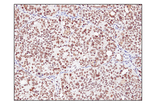 Immunohistochemistry Image 3: SS18 (D6I4Z) Rabbit mAb