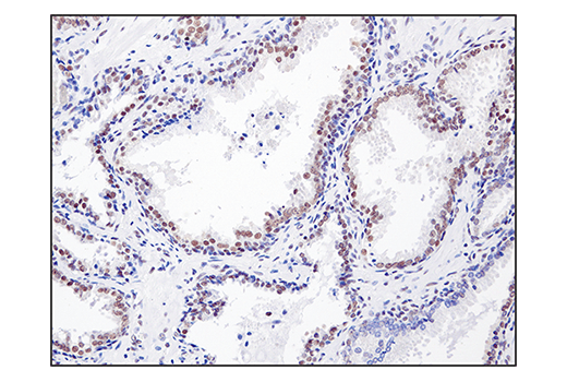 Immunohistochemistry Image 4: SS18 (D6I4Z) Rabbit mAb
