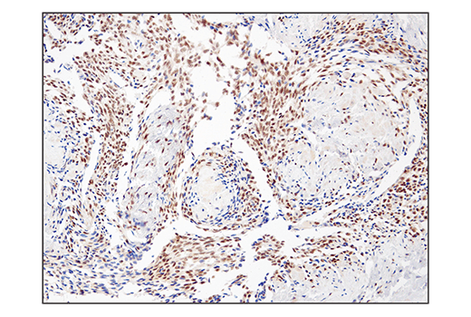 Immunohistochemistry Image 5: SS18 (D6I4Z) Rabbit mAb