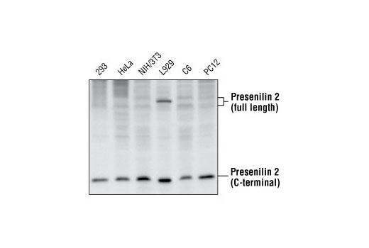 Western Blotting Image 1: Presenilin 2 Antibody