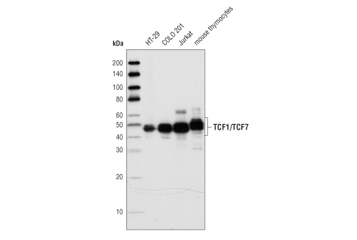  Image 6: Wnt/β-Catenin Activated Targets Antibody Sampler Kit