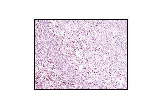 Immunohistochemistry Image 3: TCF1/TCF7 (C63D9) Rabbit mAb