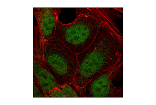 Immunofluorescence Image 2: TCF1/TCF7 (C63D9) Rabbit mAb