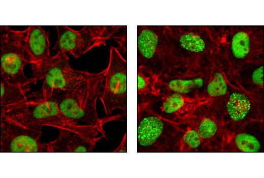 Immunofluorescence Image 1: RPA32/RPA2 (4E4) Rat mAb
