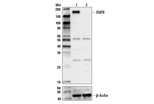 Western Blotting Image 1: EGF Receptor Antibody