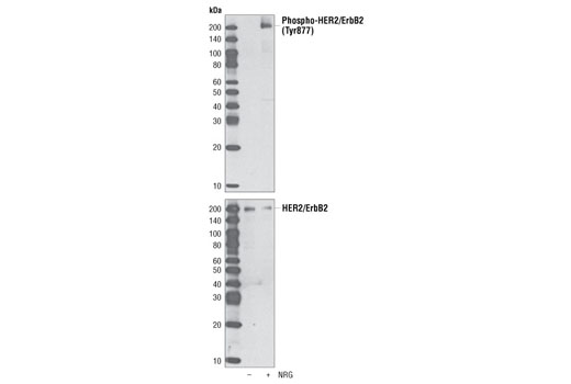 Western Blotting Image 1: Phospho-HER2/ErbB2 (Tyr877) Antibody