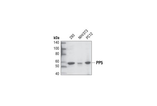 Western Blotting Image 1: PP5 Antibody