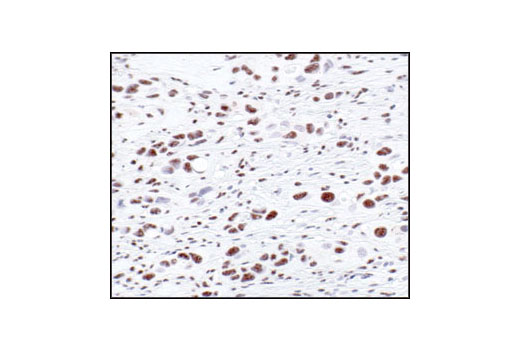 Immunohistochemistry Image 1: Phospho-(Thr) MAPK/CDK Substrate Mouse mAb