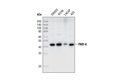 Western Blotting Image 1: PAR-4 Antibody