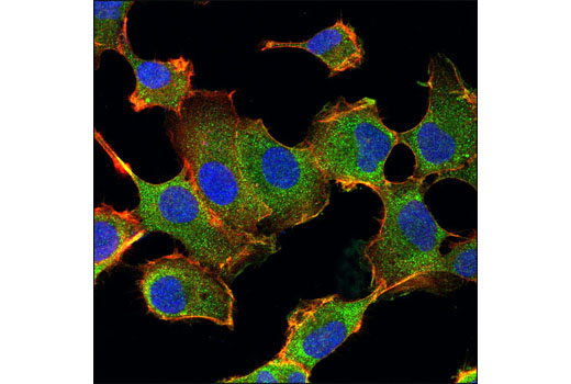 Immunofluorescence Image 1: PAR-4 Antibody