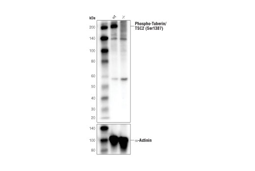 Western Blotting Image 2: Phospho-Tuberin/TSC2 (Ser1387) (D2R3A) Rabbit mAb