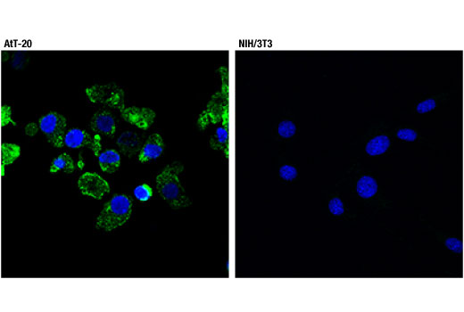 Immunofluorescence Image 2: POMC (D3R1U) Rabbit mAb