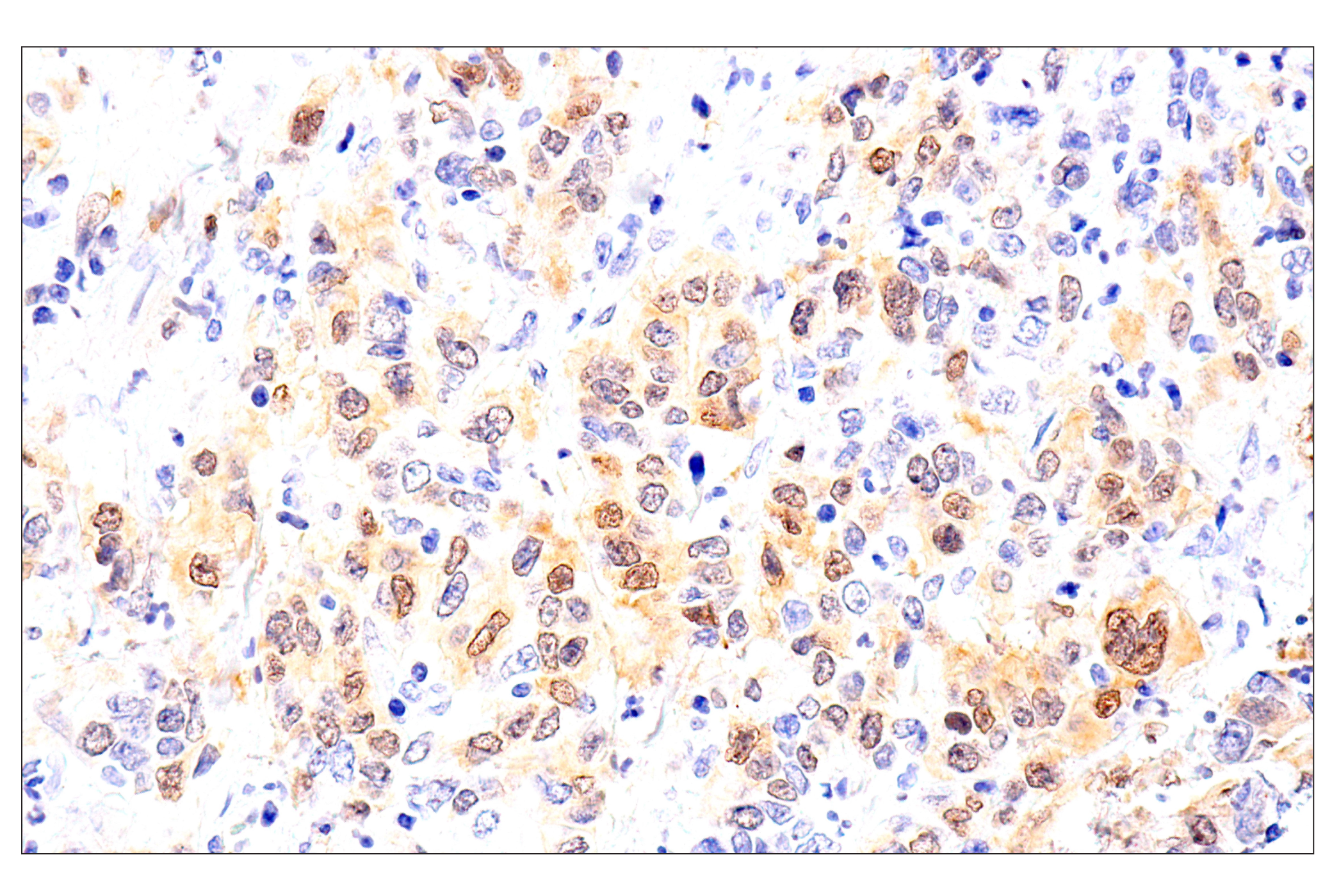 Immunohistochemistry Image 7: Chk1 (2G1D5) Mouse mAb