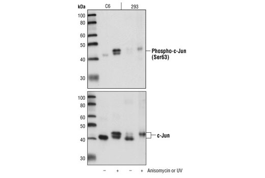  Image 2: PhosphoPlus® c-Jun (Ser63) and c-Jun (Ser73) Antibody Kit