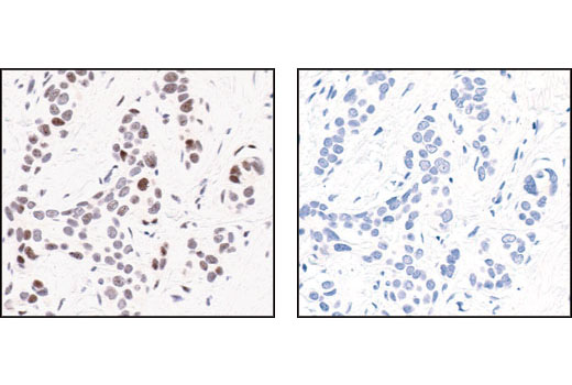  Image 4: PhosphoPlus® c-Jun (Ser63) Antibody Duet