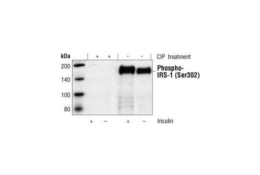 Western Blotting Image 1: Phospho-IRS-1 (Ser302) Antibody