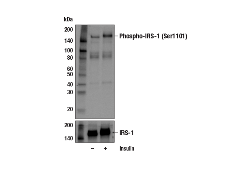 Western Blotting Image 1: Phospho-IRS-1 (Ser1101) Antibody