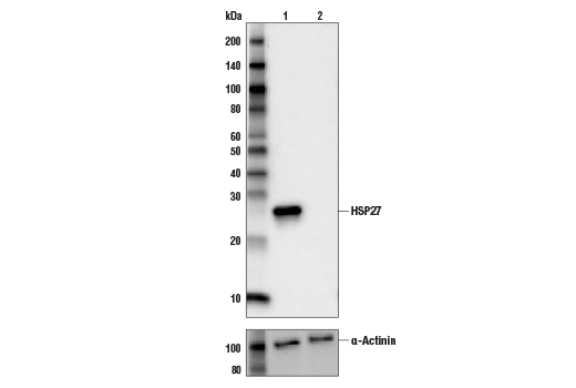  Image 1: HSP27 Antibody Sampler Kit