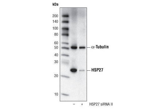  Image 10: HSP27 Antibody Sampler Kit