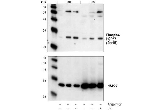 Western Blotting Image 1: Phospho-HSP27 (Ser15) Antibody