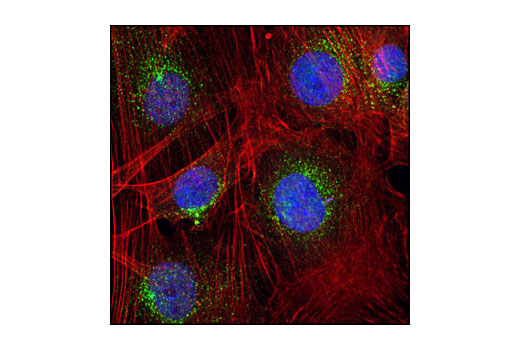 Immunofluorescence Image 1: EEA1 Antibody