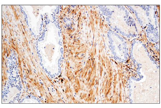  Image 69: Small Cell Lung Cancer Biomarker Antibody Sampler Kit