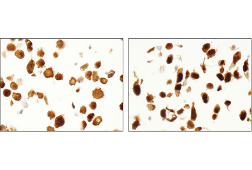 Immunohistochemistry Image 3: HSP70 (D1M6J) Mouse mAb (BSA and Azide Free)