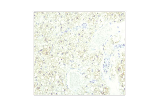 Immunohistochemistry Image 2: ATGL (30A4) Rabbit mAb
