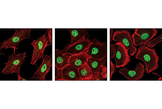 Immunofluorescence Image 1: PRMT1 (A33) Antibody
