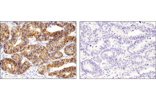 Immunohistochemistry Image 4: Non-phospho (Active) β-Catenin (Ser45) (D2U8Y) XP® Rabbit mAb (BSA and Azide Free)