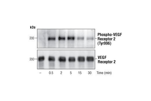 Western Blotting Image 1: Phospho-VEGF Receptor 2 (Tyr996) Antibody