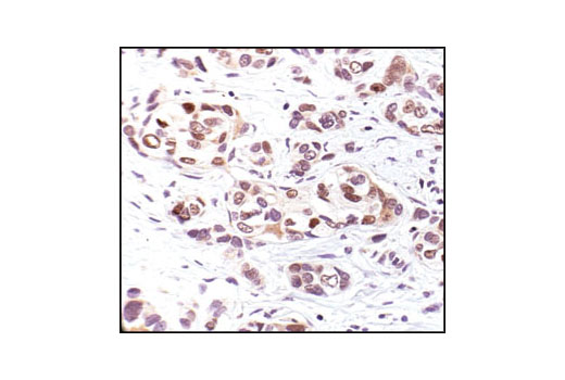 Immunohistochemistry Image 1: Phospho-p53 (Ser33) Antibody