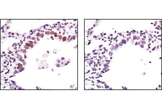 Immunohistochemistry Image 3: Phospho-p53 (Ser33) Antibody