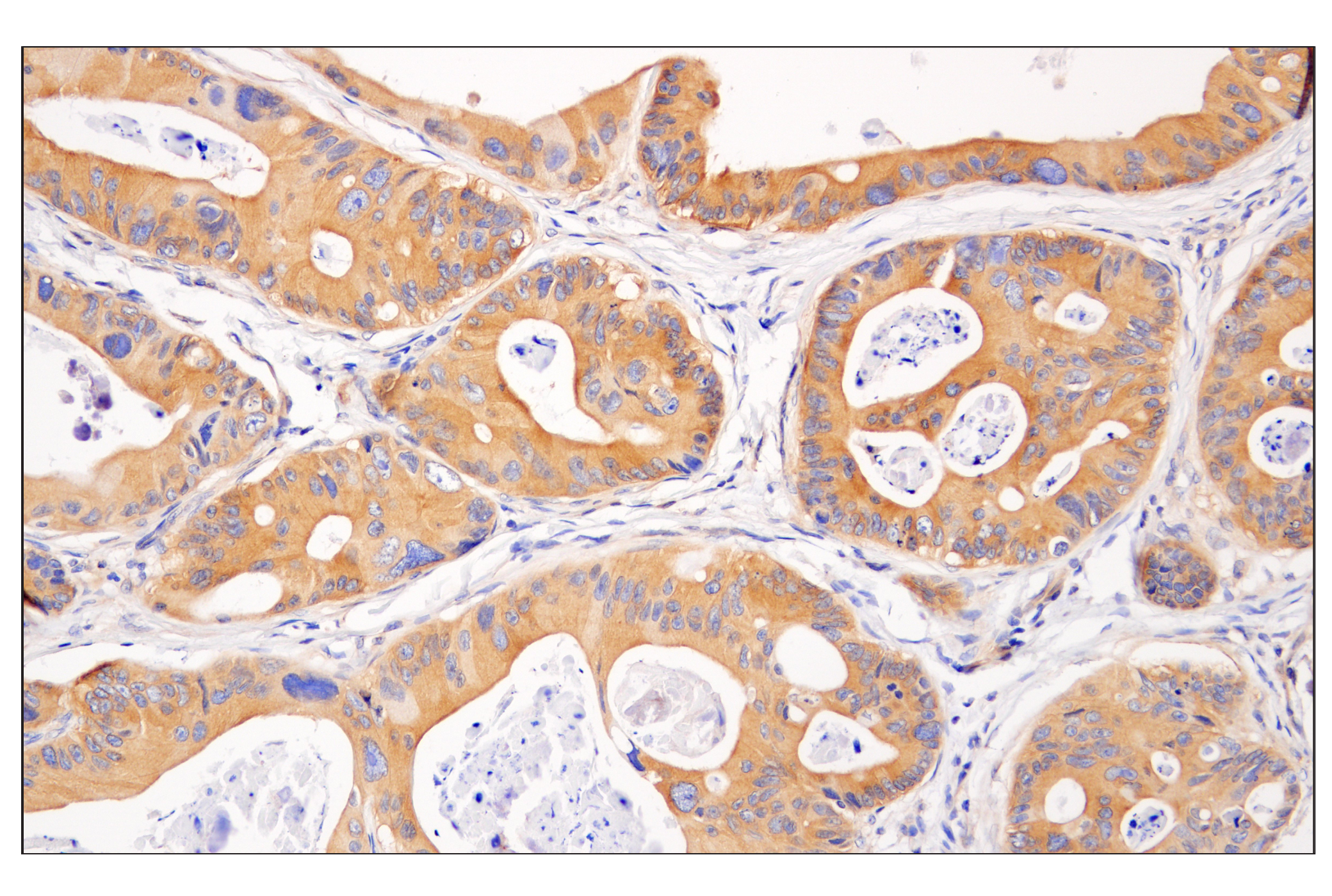  Image 23: PPARγ Regulated Fatty Acid Metabolism Antibody Sampler Kit