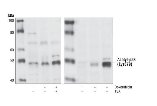 Western Blotting Image 1: Acetyl-p53 (Lys379) Antibody