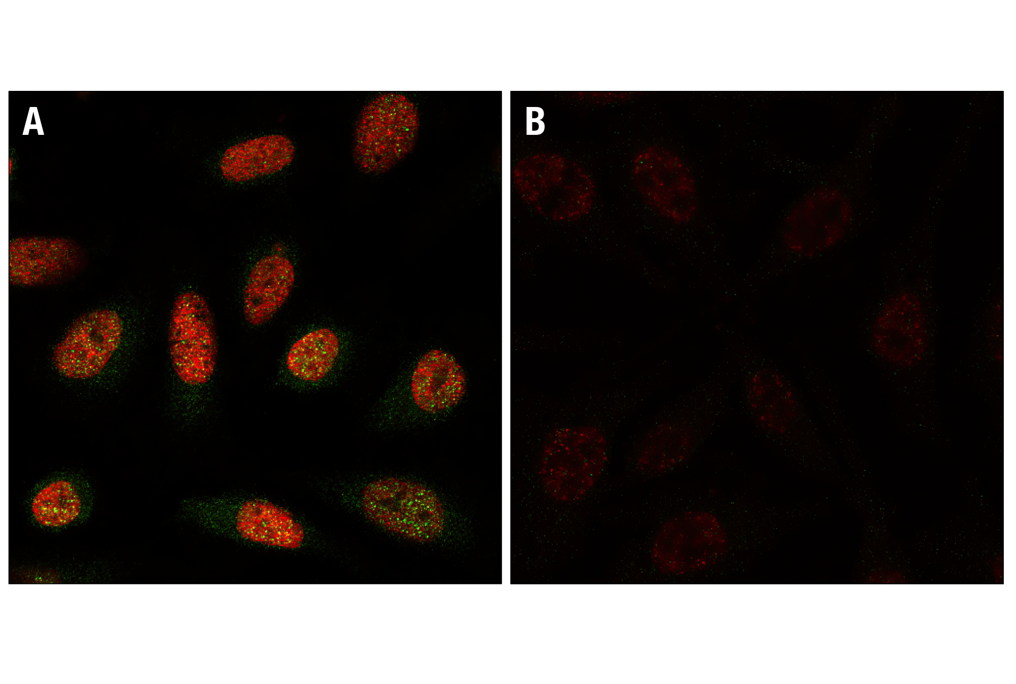 Immunofluorescence Image 1: Phospho-Histone H2A.X (Ser139) Antibody