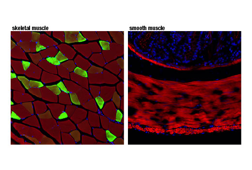 Immunofluorescence Image 1: Myoglobin (D2F5X) Rabbit mAb