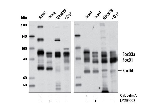 Western Blotting Image 1: Phospho-FoxO1 (Thr24)/FoxO3a (Thr32)/FoxO4 (Thr28) (4G6) Rabbit mAb