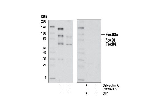  Image 11: Forkhead Signaling Antibody Sampler Kit