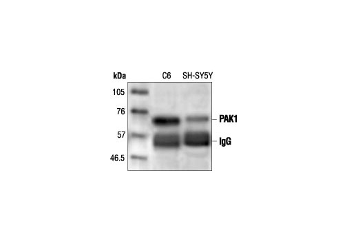  Image 14: PAK 1/2/3 Antibody Sampler Kit