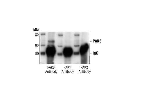 Immunoprecipitation Image 1: PAK3 Antibody