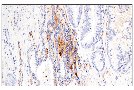 Immunohistochemistry Image 6: CD54/ICAM-1 (E3Q9N) XP® Rabbit mAb (BSA and Azide Free)