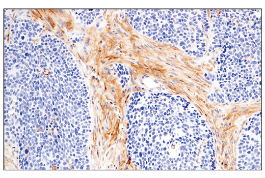 Immunohistochemistry Image 7: CD54/ICAM-1 (E3Q9N) XP® Rabbit mAb (BSA and Azide Free)