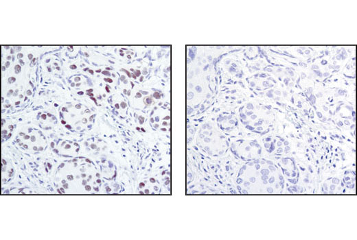 Immunohistochemistry Image 2: HP1α/β (C7F11) Rabbit mAb