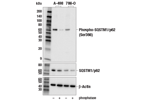 Western Blotting Image 1: Phospho-SQSTM1/p62 (Ser366) Antibody