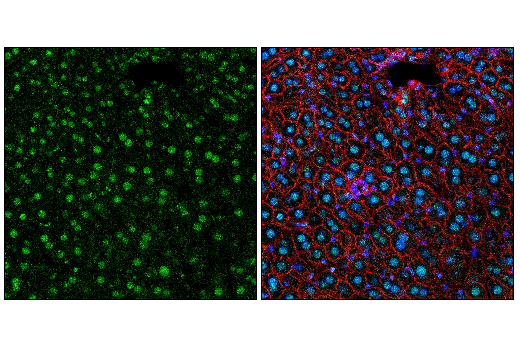 Immunofluorescence Image 1: Fibrillarin (C13C3) Rabbit mAb